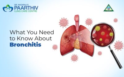 What You Need to Know About Bronchitis